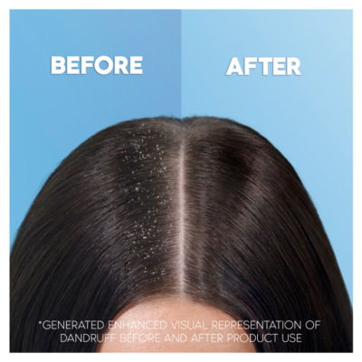 Head and Shoulders Smooth & Silky Anti Dandruff Shampoo thumbnail 4
