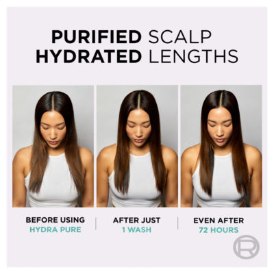 L’Oréal Paris Elvive Hydra Pure Exfoliating Pre-Shampoo Scalp Serum for Oily Scalp & Roots 102ml thumbnail 4