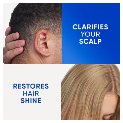 Clarify & Shine Anti-Dandruff Shampoo 400ml.Works against Oil and Itch thumbnail 4