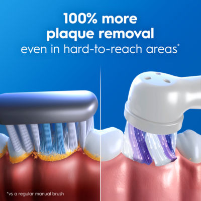 iO 2 Electric Toothbrush | 1 Brush Head thumbnail 3