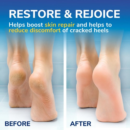 Scholl Cracked Heel Cream thumbnail 4