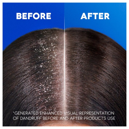 Head and Shoulders Classic Clean Anti Dandruff Shampoo thumbnail 4