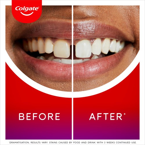 Colgate Max White Ultimate Radiance Whitening Toothpaste thumbnail 5