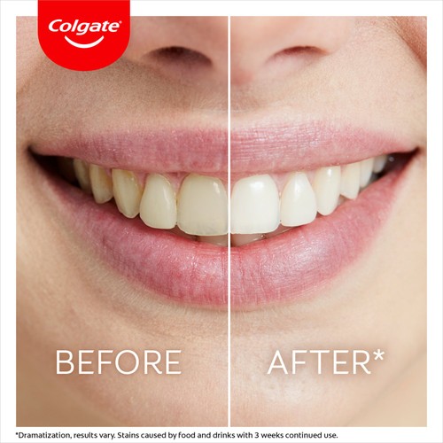 Colgate Max White Overnight Teeth Whitening Pen 35 Nightly Treatments thumbnail 4