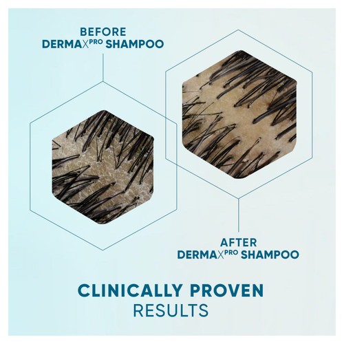 Head & Shoulders Derma X Pro Soothe Shampoo thumbnail 3