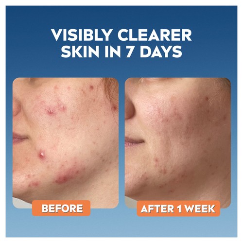 NIVEA Derma Skin Clear Toner thumbnail 6