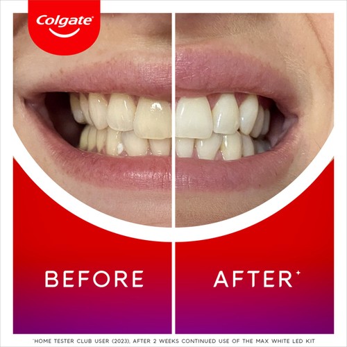 Colgate Max White Ultimate At Home LED Teeth Whitening Kit thumbnail 3