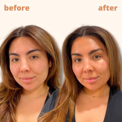 Skinny Tan Notox Face Tanning Drops thumbnail 4