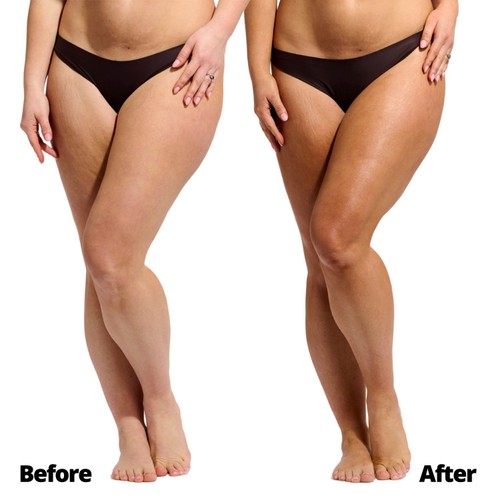 Skinny Tan Self-Tanning Mousse Medium  thumbnail 2