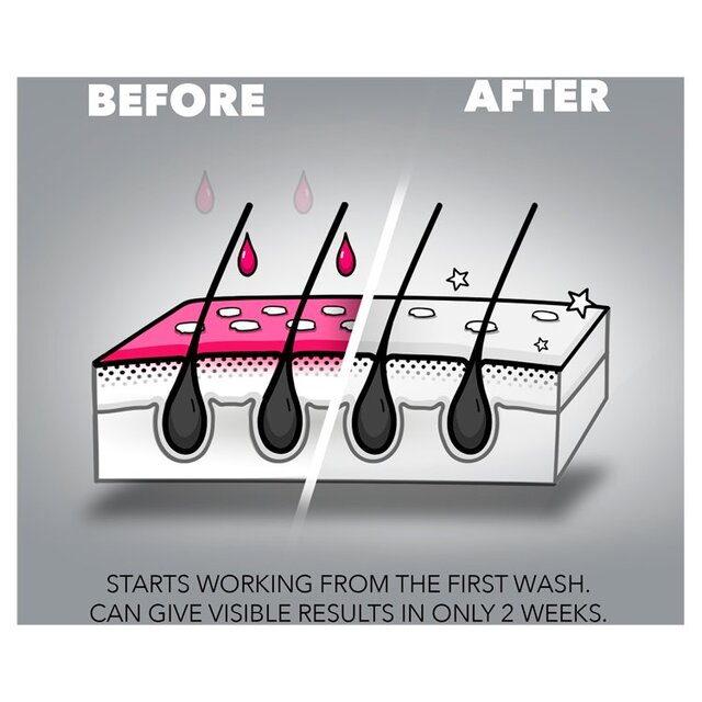 Nizoral Anti-Dandruff Shampoo thumbnail 7