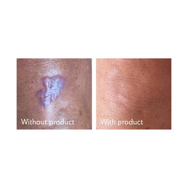 Science of Skin Solution for Scars thumbnail 3