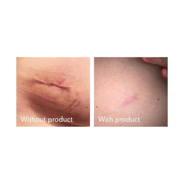 Science of Skin Solution for Scars thumbnail 4