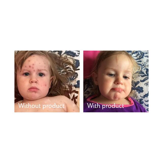 Science of Skin Solution for Scars thumbnail 5