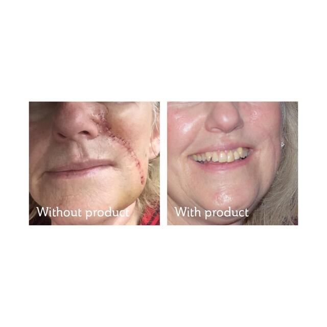 Science of Skin Solution for Scars thumbnail 6