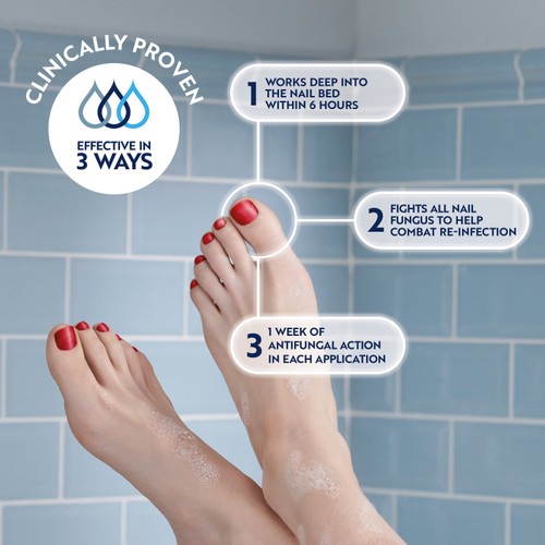 Curanail 5% Fungal Nail Treatment thumbnail 6