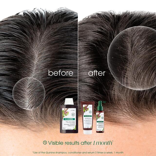 Klorane Shampoo with Quinine and Organic Edelweiss for Thinning Hair thumbnail 5