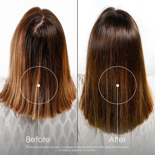 Klorane Shampoo with Quinine and Organic Edelweiss for Thinning Hair thumbnail 7