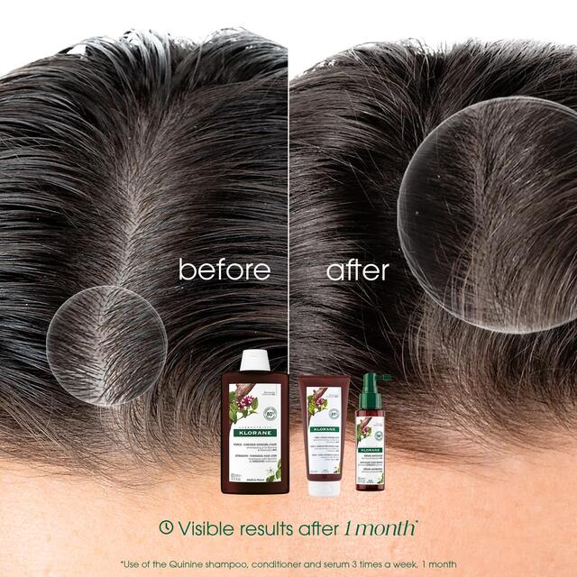 Klorane Conditioner with Quinine and Organic Edelweiss for Thinning Hair thumbnail 3