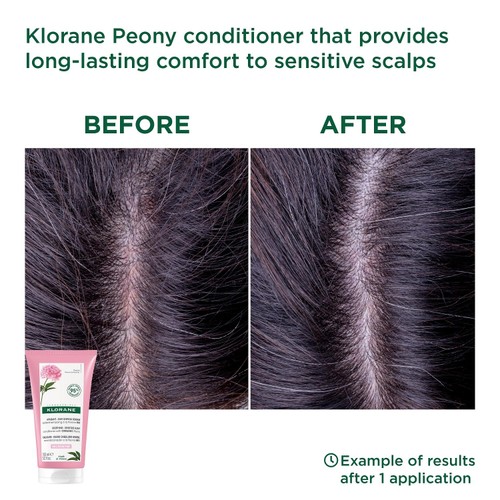 Klorane Soothing Conditioner with Organic Peony for Sensitive Scalps thumbnail 6