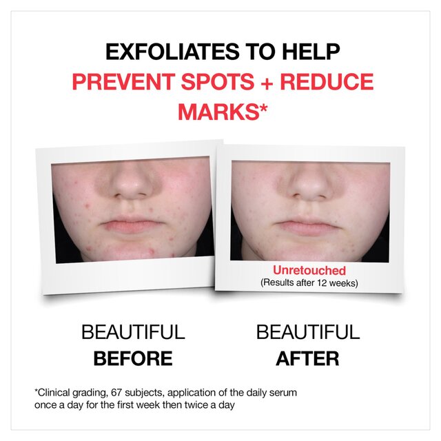 Neutrogena Clear and Defend+ Serum 10% with AHA/PHA + Salicylic Acid thumbnail 5