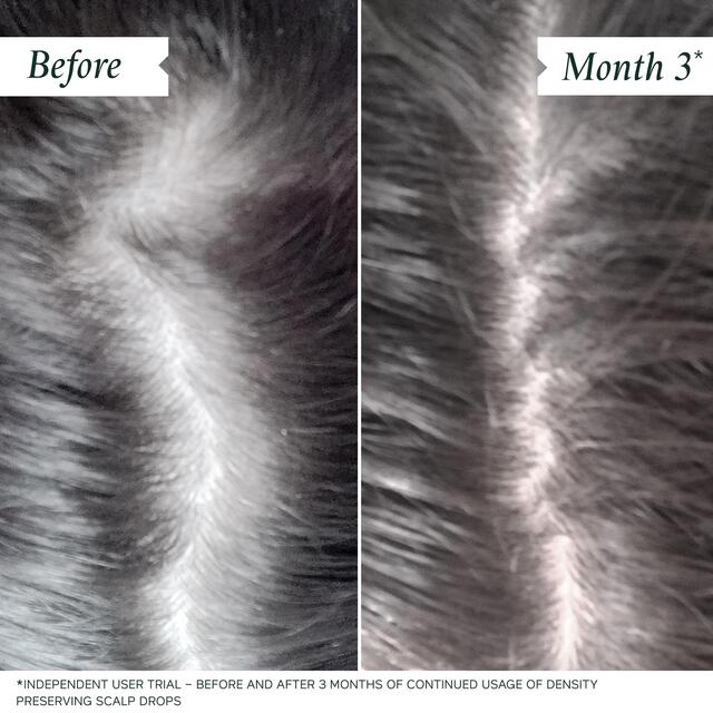 Philip Kingsley Density Preserving Scalp Drops thumbnail 2