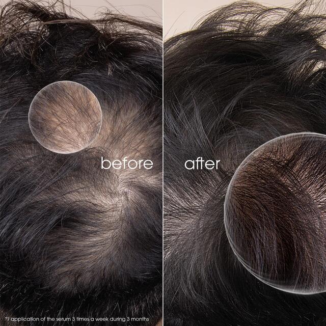 Klorane Quinine & Edelweiss Serum for Thinning Hair thumbnail 5