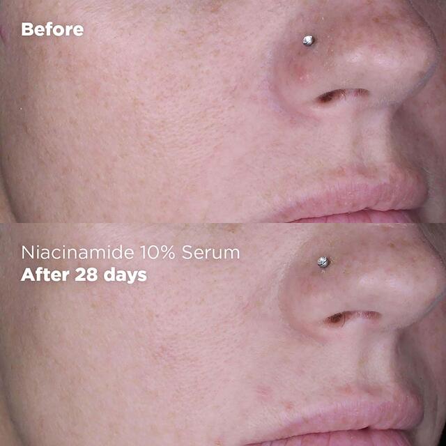 Skin Republic Niacinamide 10% + Zinc 1% Serum thumbnail 4