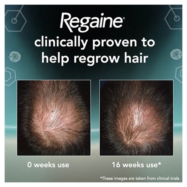 Regaine for Men Extra Strength Hair Regrowth Scalp Foam (1 month supply) thumbnail 4