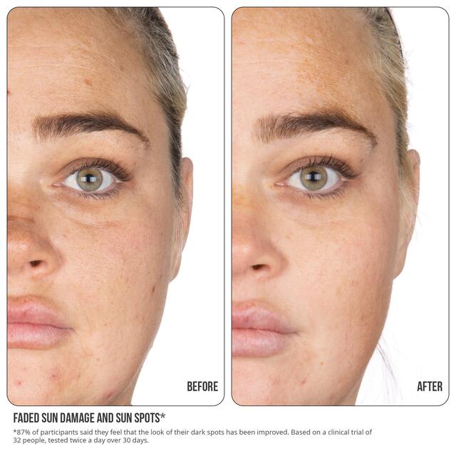 Nip+Fab Vitamin C Fix Concentrate Extreme 15% thumbnail 5