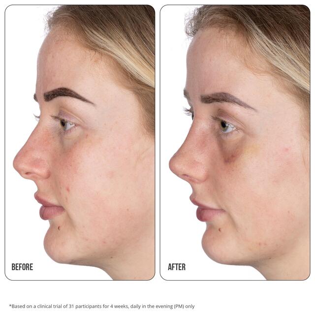 Nip+Fab Retinol Fix Blemish Treatment Gel 10% thumbnail 6