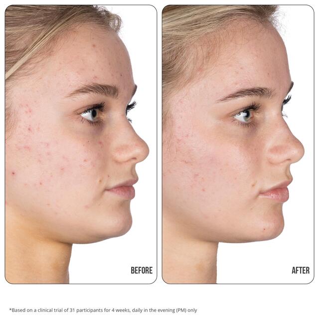 Nip+Fab Retinol Fix Blemish Treatment Gel 10% thumbnail 7