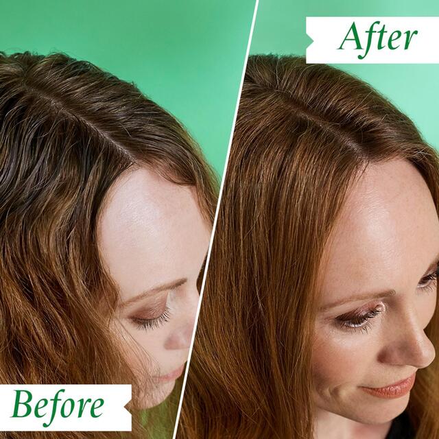 Philip Kingsley Flaky Itchy Regime Kit thumbnail 3