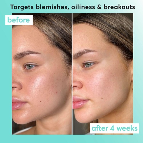 Super Facialist Clear Skin Pore Clarity Daily Exfoliator thumbnail 4