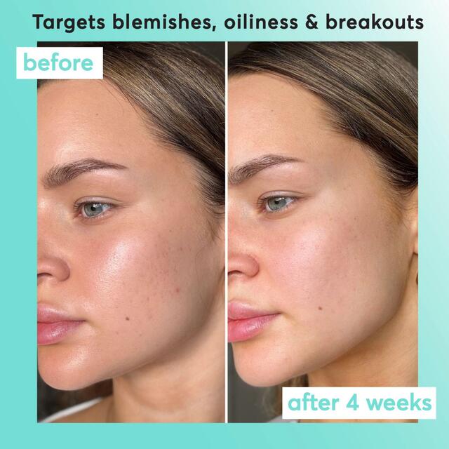 Super Facialist Clear Skin Pore Clarity Daily Exfoliator thumbnail 4