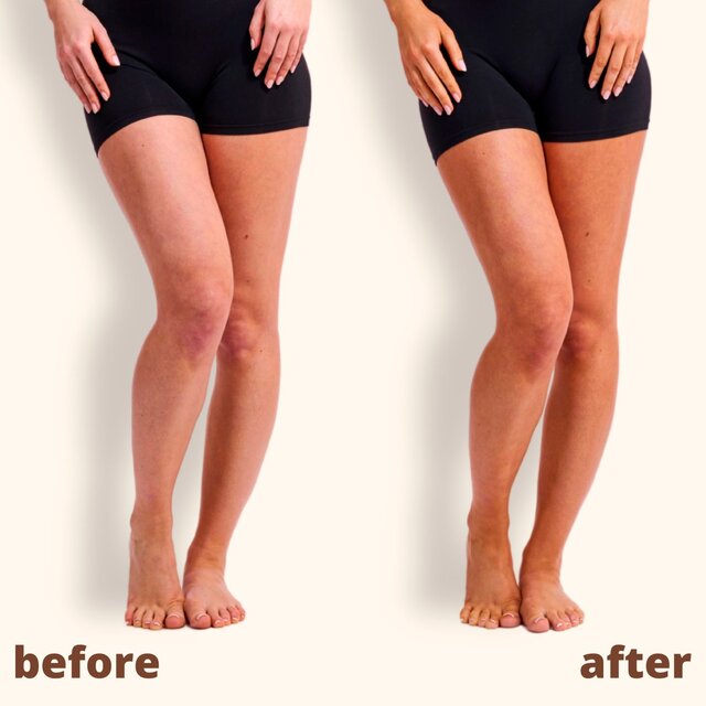 Skinny Tan Tan & Tone Self -Tanning Oil Medium 145ml thumbnail 4