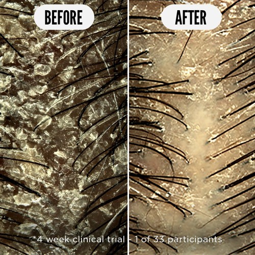 Noughty Care Taker Scalp Soothing Tonic thumbnail 3