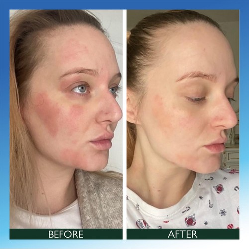 Sorted Skin Intensive Rescue Face Lotion- Microbiome Prebiotic Based thumbnail 5
