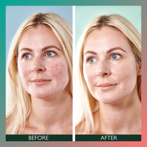 Sorted Skin 5 in 1 Anti-Redness SPF50 Day Cream - Prebiotic Microbiome thumbnail 3