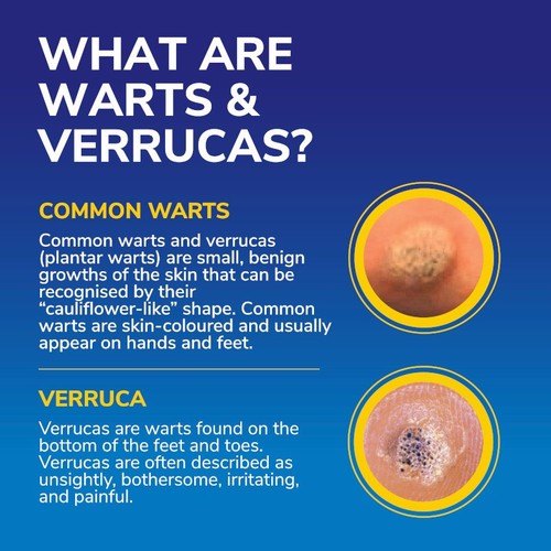 Dr Scholl's Wart & Verruca FreezeAway Max thumbnail 4