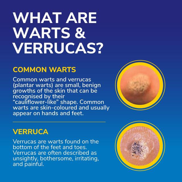 Dr Scholl's Wart & Verruca FreezeAway Max thumbnail 3