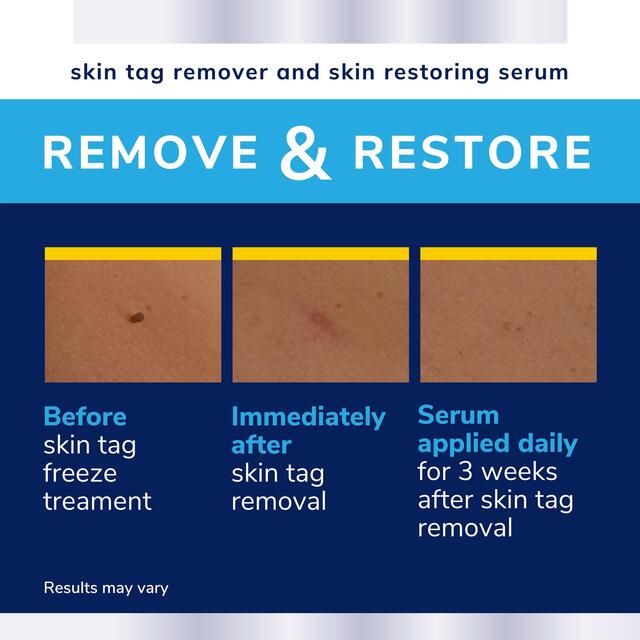 Scholl Skin Tag Complete Care thumbnail 6