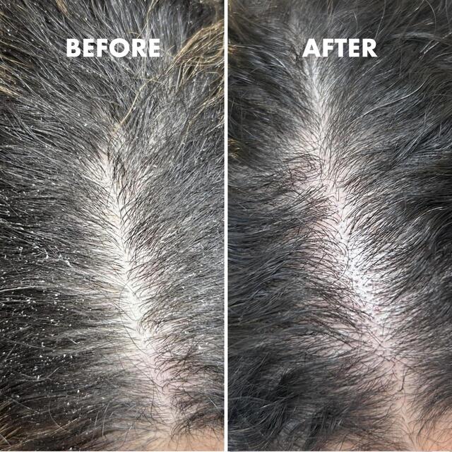 Umberto Giannini Scalp Restore Kit thumbnail 2