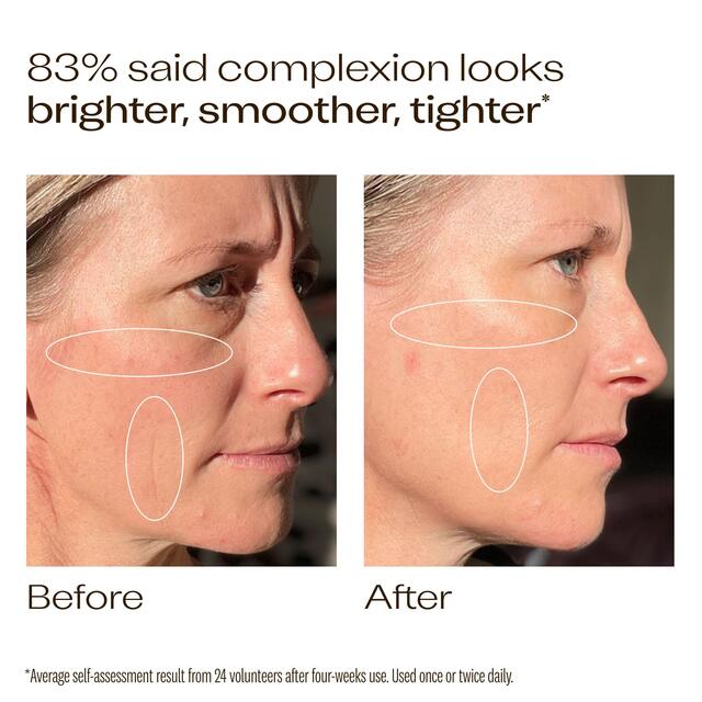 Trilogy Vitamin C+ Super Serum thumbnail 5