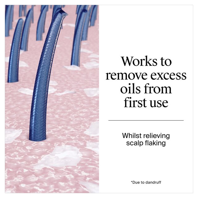 Neutrogena T-Gel Anti-Dandruff Oily Scalp Shampoo thumbnail 5