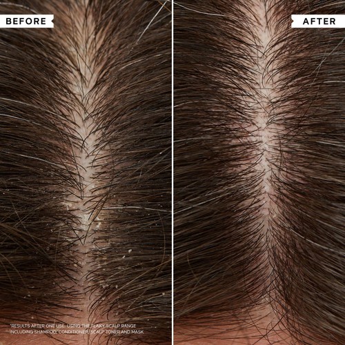 Philip Kingsley Flaky Itchy Scalp Curl Shampoo thumbnail 5