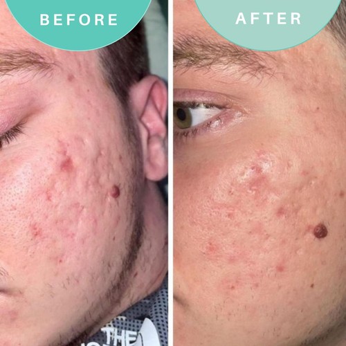 Skin Genius Soothe Operator Soothing Moisturiser thumbnail 3