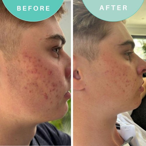 Skin Genius Alls Well That Gels Well Leave-On Purifying Gel thumbnail 3
