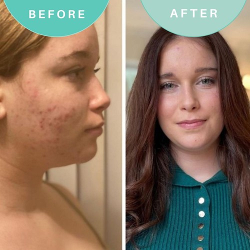 Skin Genius Best Cleanse Forever Cleansing Face Wash thumbnail 3