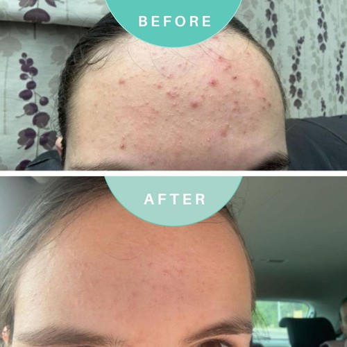 Skin Genius Best Cleanse Forever Cleansing Face Wash thumbnail 4