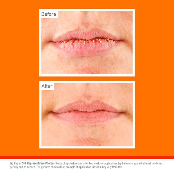 O'Keeffe's Lip Repair & Protect SPF 15 Lip Balm 4.2g thumbnail 5